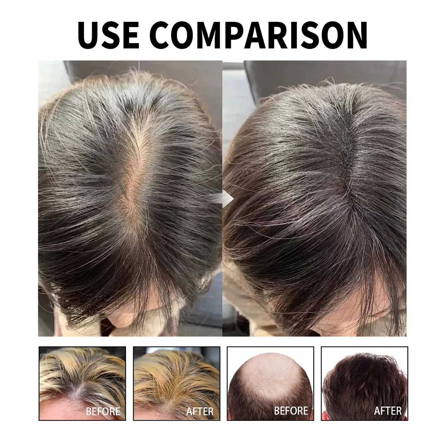 Hair Loss Treatment Shampoo Anti-itch Anti Dandruff Oil Control Hair Growth Serum Oil Scalp Root Thicker Fast Regrowth Essence